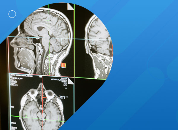 Comparative Study of Cranial Anthropometric Measurement by Traditional Calipers to Computed Tomography and Three-dimensional Photogrammetry